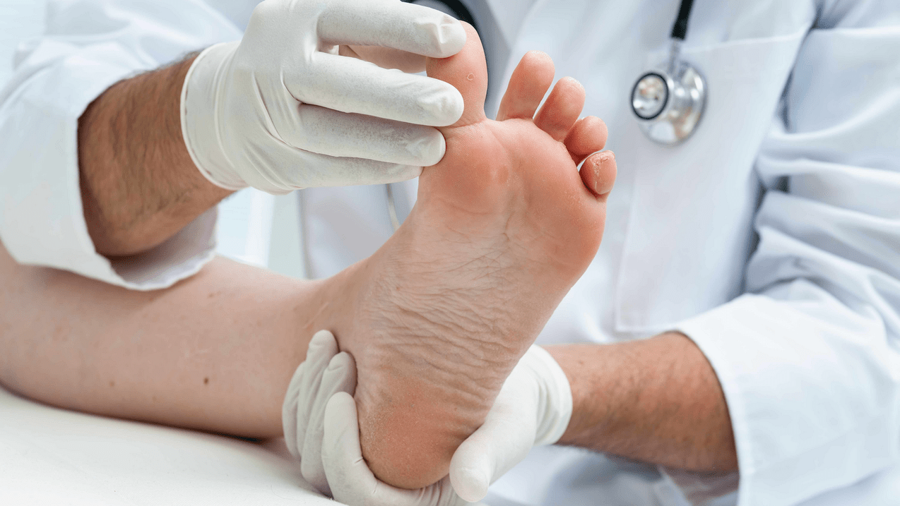 pregled kože nogu na dogovoru sa stručnjakom