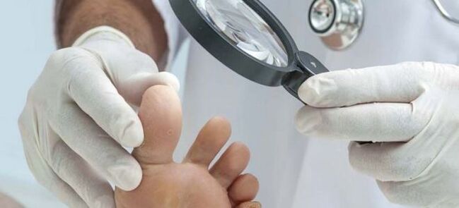 Pregledi prije početka liječenja gljivica