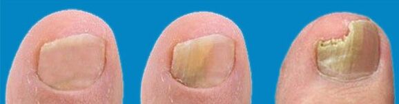 Proces razvoja gljivica