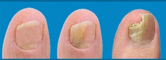 proces razvoja gljivica